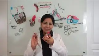 Internal and External Features of the Heart   For Beginners Part 3