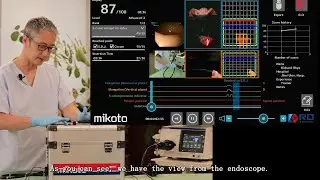 Colonoscopy Insertion Technique with Mikoto Model: How to access to your recorded data?