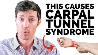 Carpal Tunnel Syndrome? Check Your Thyroid