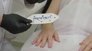 Сочетание хемоэксфолиации Enerpeel Hands и ремоделирования кожи Profhilo Body в области кистей рук