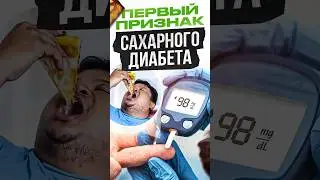 Первый признак САХАРНОГО ДИАБЕТА 