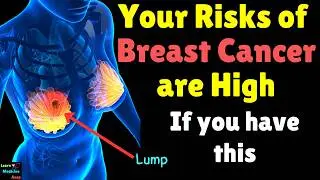 Causes of Breast Cancer | Breast Cancer Risk Factors | Risk Factors of Breast Cancer