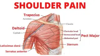 Shoulder Pain