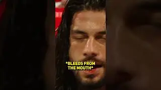 The Secret Of How Wrestlers Bleed From The Mouth