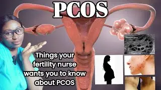 Things no one tells you about PCOS// Unexpected symptoms of PCOS// How do you reverse it??