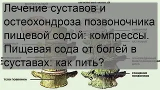 Лечение суставов и остеохондроза позвоночника пищевой содой: компрессы. Пищевая сода от болей в су.