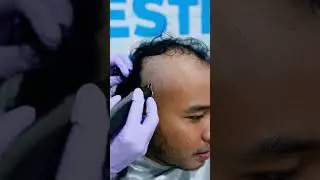 INGAT TANAM RAMBUT YA ESTRADA !!