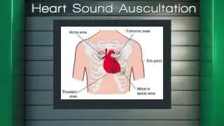 Head to Toe Assessment: Cardio ~ivyVILOs~ (Ivy Tech Community College, School of Nursing)