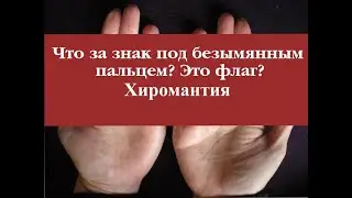 что за знак под безымянным пальцем? это флаг? хиромантия