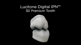 Dentsply Sirona Lucitone Digital Print Denture Lab Benefits