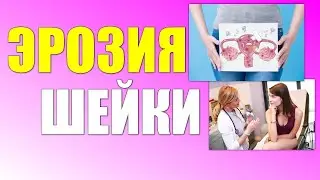 ЭРОЗИЯ ВО ВРЕМЯ БЕРЕМЕННОСТИ | Как влияет эрозия шейки матки на беременность и надо ли ее лечить