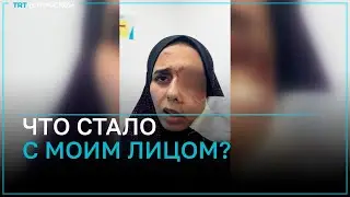 Палестинка умоляет врачей спасти ее зрение