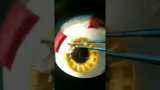 эта травма очень опасна 