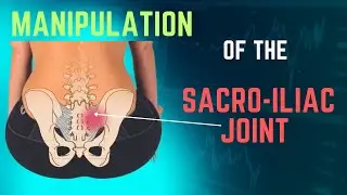 How to manipulate the Sacroiliac Joint (SIJ)