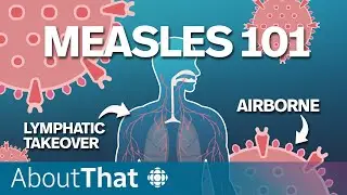 Measles: Understanding the most contagious preventable disease | About That