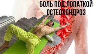 Быстро избавься от кифоза и сутулости.