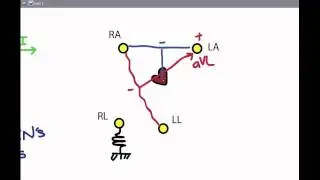 EKG 02: Electrodes and Leads