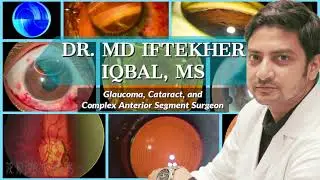 MIIQ 58: Cataract Surgical Step | Capsulorhexis 01:Intumescent Cataract | DR. MD IFTEKHER IQBAL RAJU