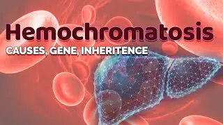 Hemochromatosis - Cause, Gene & Inheritance | HFE gene |  Iron storage in Liver | Transferrin