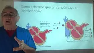 Edema agudo del pulmón. Insuficiencia Cardiaca. Fraccion de eyeccion. Precarga y Postcarga