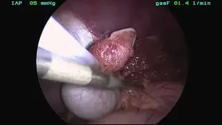 Gel-point Liver Vetforum