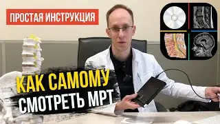 Как самому смотреть снимки МРТ с диска или флешки