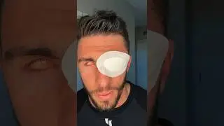 I LOST MY EYEBALL 😮