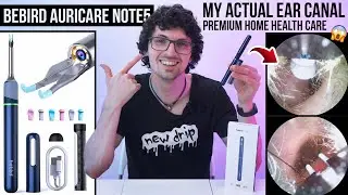 Bebird AuriCare Note5 Pro Review: A Health Care Must-Have! (Otoscope, Tweezer & Live Video Sharing)