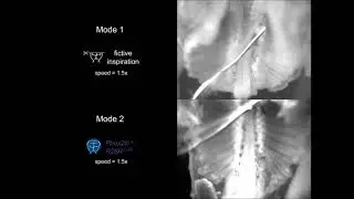 Phasic inhibition as a mechanism for generation of rapid respiratory rhythms