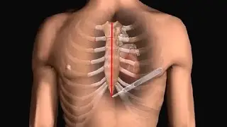 How Does Heart Bypass Surgery Work? Coronary Artery Bypass Graft Procedure Animation - CABG Video