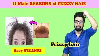 7 Main & COMMON Reasons of FRIZZY HAIR & it's Solutions - Part 1 | 