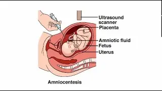 Diagnostic and Ultrasound Screening Test in Gynae | Fetal Testing during Pregnancy | Fetoscopy