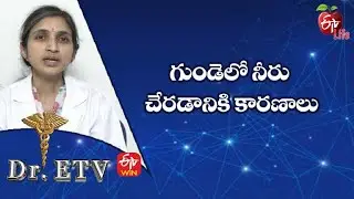 Fluid Around Heart - Causes | గుండెలో నీరు చేరడానికి కారణాలు | Dr.ETV | 18th April 2022 | ETV Life