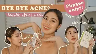 Affordable Solution to Acne Problems + New Fave Tinted Sunscreen | Made in Korea | 1 Week Review