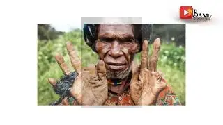 Finger Cutting Tribe (Dani Tribe) of Papua