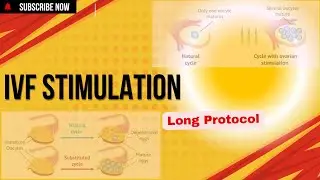 IVF Stimulation : Long Protocol