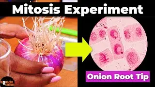 Mitosis Experiment Onion Root Tip Procedure