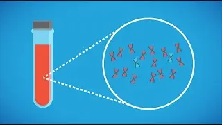 Prenatal screening methods