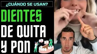 DIENTES DE QUITA Y PON - ¿Cuando se utilizan y cómo funcionan?