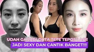 BYE BYE T3TE TEPOS!🍒 Sekarang jadi SEXY dan CANTIK😍