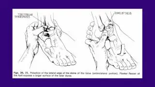 452 Gait Analysis and Differential Diagnosis