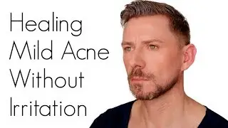 HOW TO TREAT ACNE WITHOUT IRRITATING YOUR SKIN