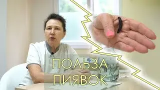 Для чего нужны пиявки? | Замена всему!