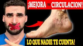 CURA la MALA CIRCULACIÓN ¡SIN REMEDIOS!