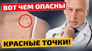 Никогда бы не подумал, что все так серьезно! Красные точки на коже