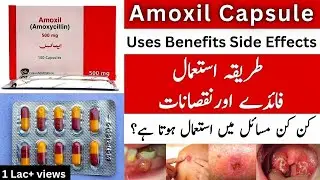 Amoxil Capsule Uses In Urdu | Amoxil Capsule 500mg | Amoxil Capsule 250 mg