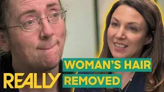 Facial Hair Stops Woman From Dating | The Bad Skin Clinic