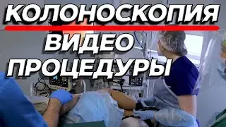 Колоноскопия под наркозом: как проводится исследование