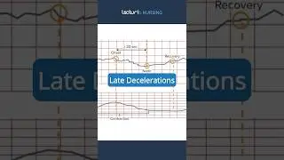 Understanding Late Decelerations in Fetal Heart Rate 🩺 #NursingStudents #FetalMonitoring