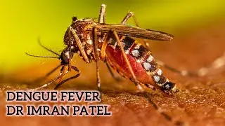 Dengue fever in Hindi | story of Tanvi | Dr Imran Patel